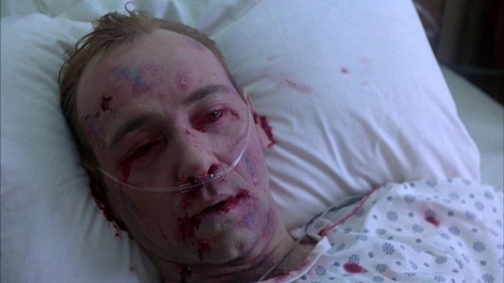 Kevin Spacey en Estallido