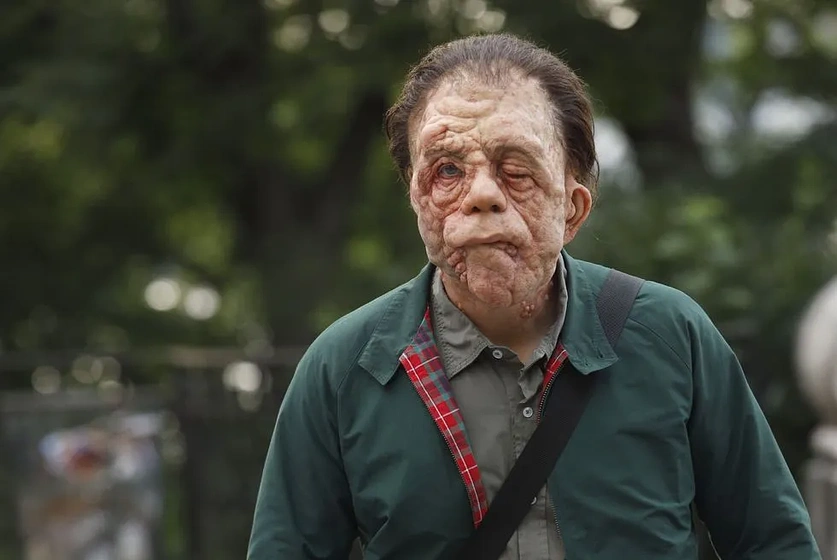 Adam Pearson en A Different Man