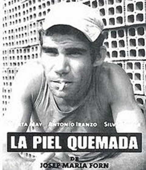 Imagen de la-piel-quemada