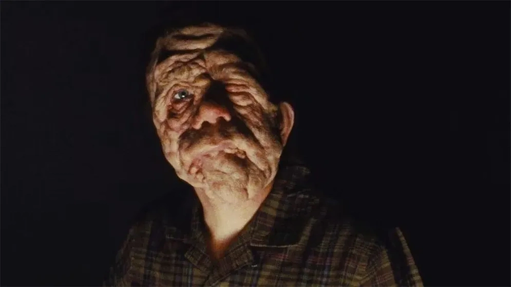 Adam Pearson en A Different Man