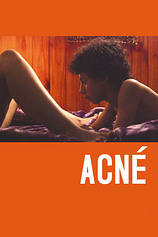 poster of movie Acné