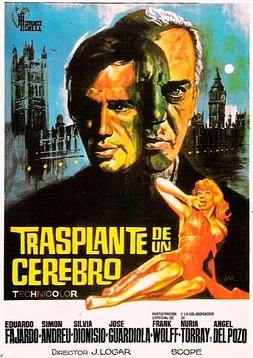 Trasplante de un Cerebro