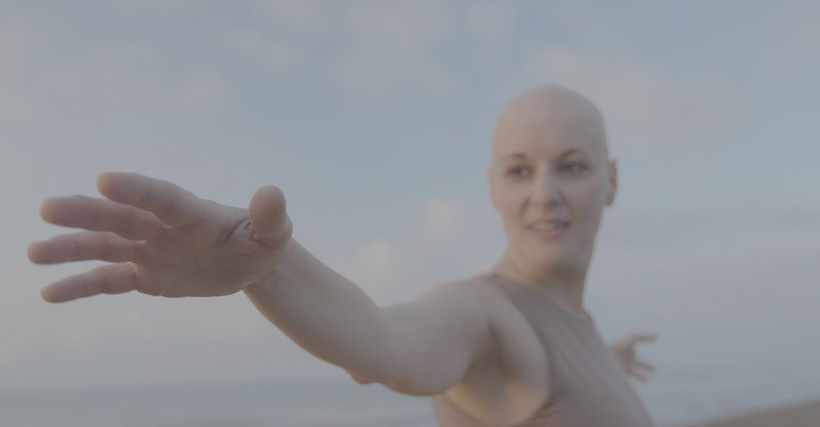 Imagen de Mujeres Calvas