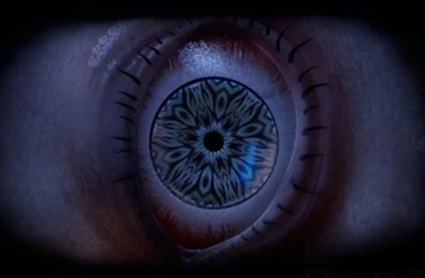 Imagen de cornee