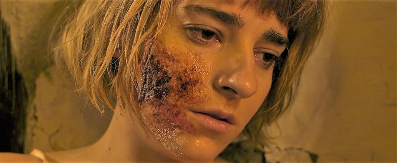 Dominga Bofill en trauma-2017