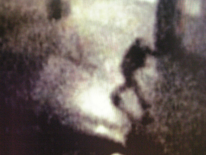 Imagen de Why Didn't Anybody Tell Me It Would Become This Bad in Afghanistan