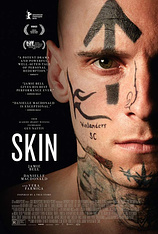 poster of movie Skin