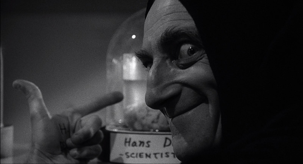 Marty Feldman en El Jovencito Frankenstein (Igor)