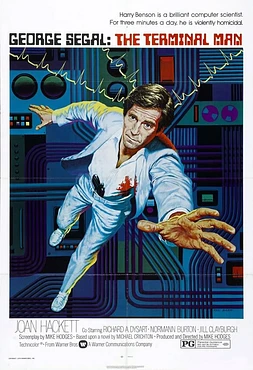 El Hombre terminal