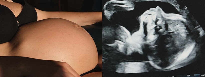 Imagen de Un Árbol es un Árbol