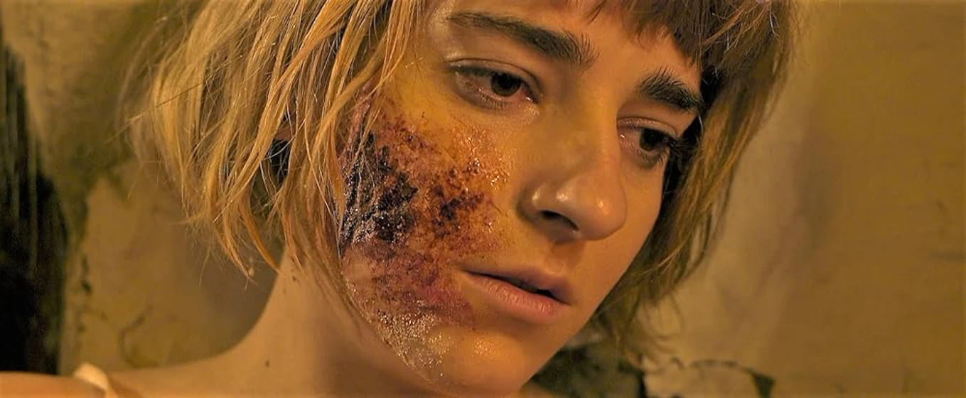 Dominga Bofill en trauma-2017